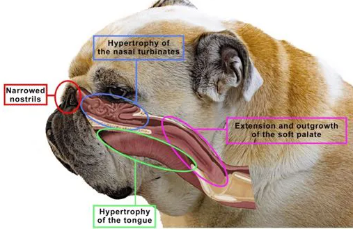 Hypertrophy of Nasal Turbinates